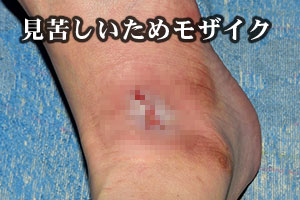 拡大写真はモザイクなしにつき注意